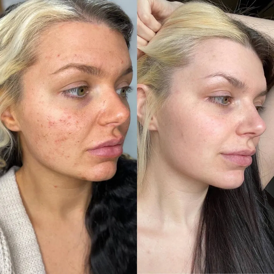 GlowSkin™ 3 Lame Exfoliere Facială + 3 CADOU