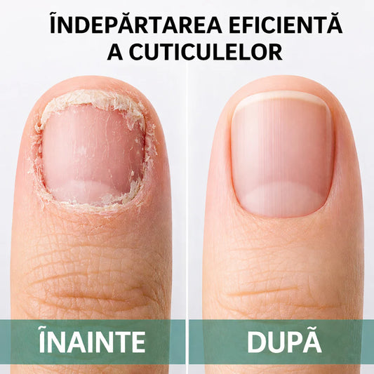 Gel Pro de Îndepartare Cuticule Fără Durere 60ml + 1 Cadou
