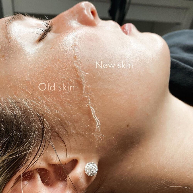 GlowSkin™ 3 Lame Exfoliere Facială + 3 CADOU