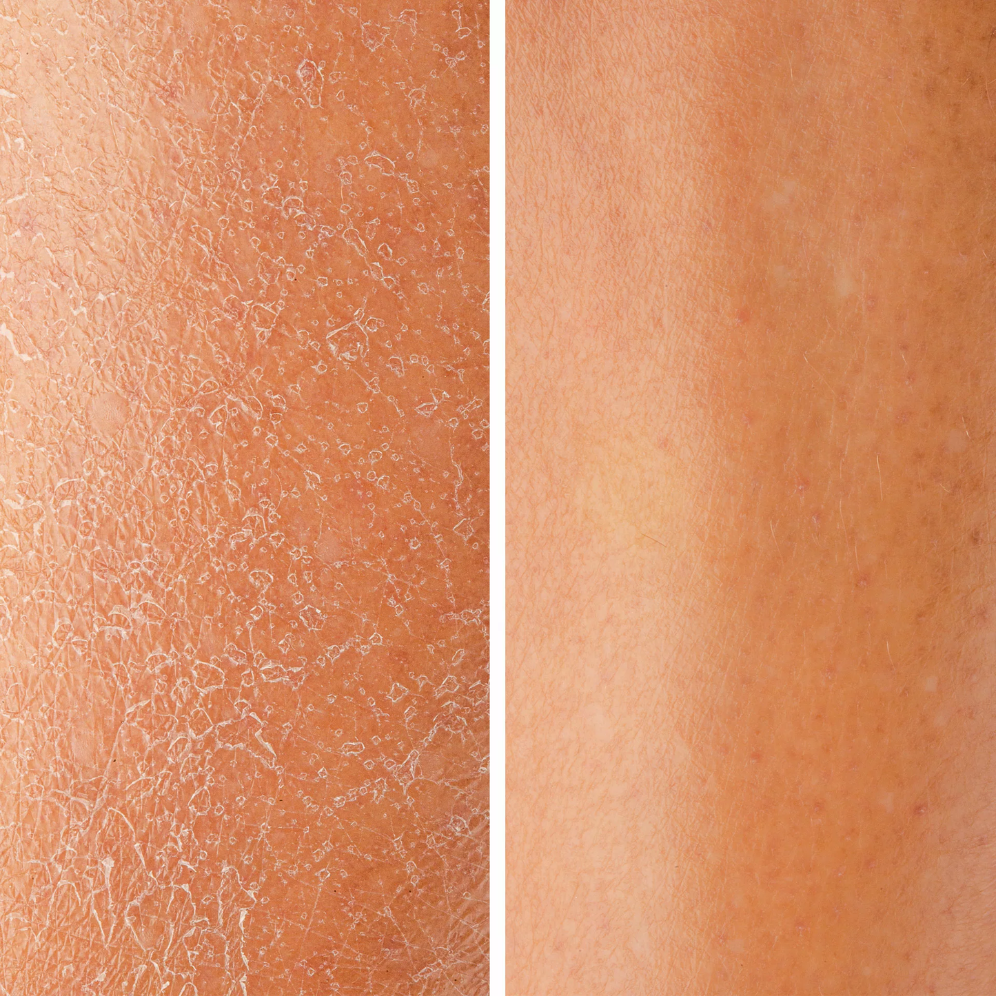 GlowSkin™ 3 Lame Exfoliere Facială + 3 CADOU