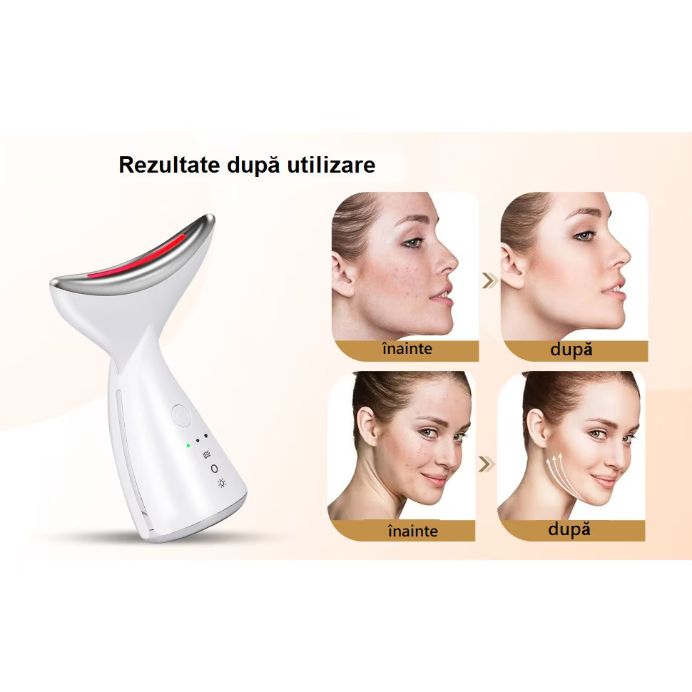 Aparat Facial SoftSkin – Tonifiere și Reducerea Ridurilor