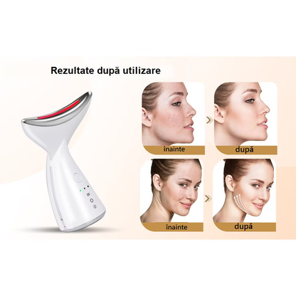 Aparat Facial SoftSkin – Tonifiere și Reducerea Ridurilor